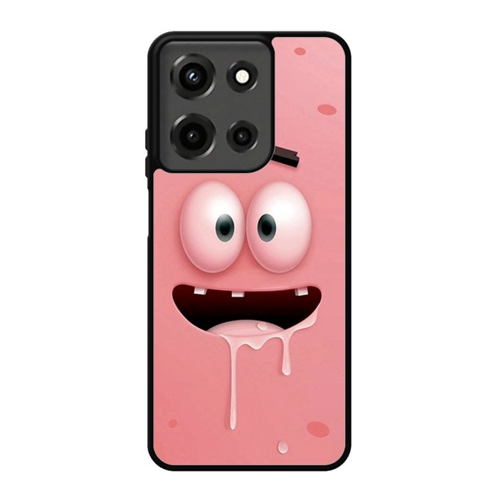patrick star face  Z0840 Motorola Moto G 5G 2025 Case